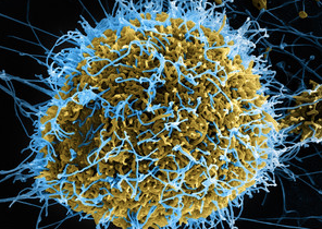 Neue Ebolavirus-Varianten schneller bekämpfen